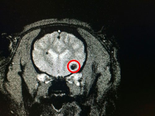 Henry's Brain MRI
