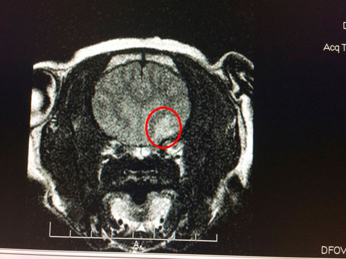 Henry's Brain MRI